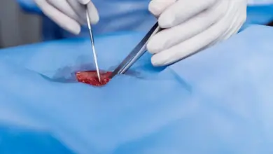 Cirurgia no ombro a laser