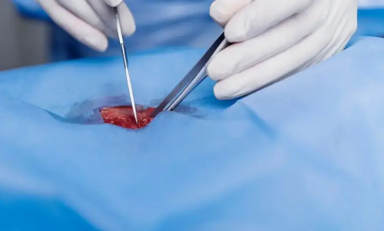 Cirurgia no ombro a laser