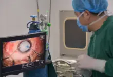 Cirurgia no ombro em Goiânia