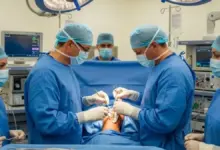 Como é feita a cirurgia para colocar prótese no ombro