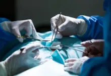 Valor de cirurgia no ombro em Goiânia