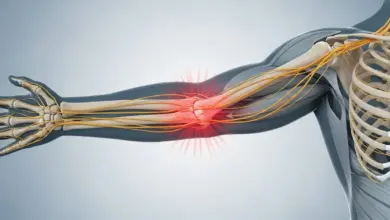 Dor no cotovelo esquerdo que irradia para a mão