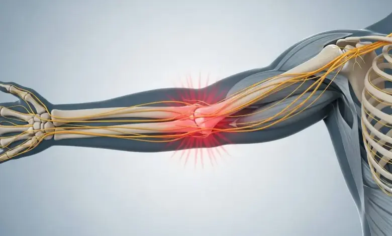 Dor no cotovelo esquerdo que irradia para a mão