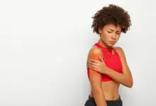 Cirurgia de bursite no ombro