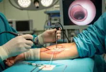 Cirurgia de cotovelo é perigoso