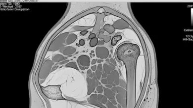 Ombro deslocado precisa de cirurgia