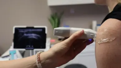 Ultrassom do ombro em consultório, exame que mostra a bursite subacromial-subdeltoidea