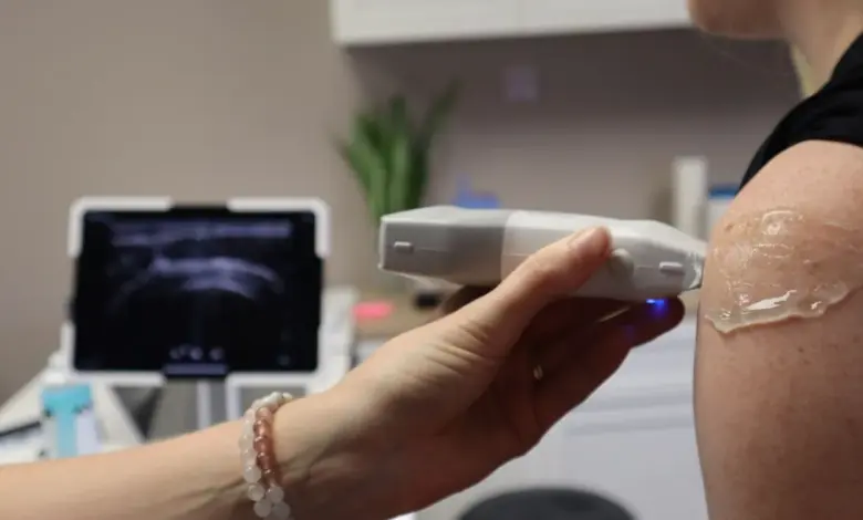 Ultrassom do ombro em consultório, exame que mostra a bursite subacromial-subdeltoidea